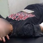 Pembusur Misterius Beraksi Lagi di Kendari, Korbannya Seorang Gadis