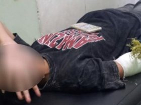 Pembusur Misterius Beraksi Lagi di Kendari, Korbannya Seorang Gadis