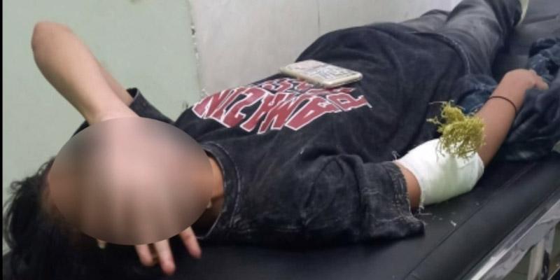 Pembusur Misterius Beraksi Lagi di Kendari, Korbannya Seorang Gadis