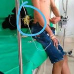 Pelajar di Kendari Jadi Korban Pembusuran OTK di Jalan 40