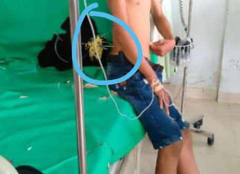 Pelajar di Kendari Jadi Korban Pembusuran OTK di Jalan 40