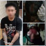 Cemburu, Pria Asal Konawe Nekat Aniaya Rekan Pacarnya Hingga Luka Robek