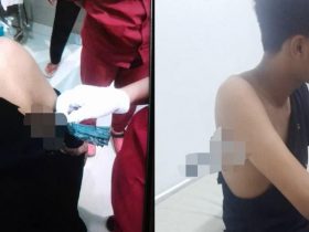 Teror Busur Kembali Terjadi, Seorang Pria di Kendari Caddi Dilarikan ke Rumah Sakit