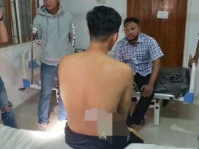 Tegur Pengendara yang Ngebut, Seorang Buruh Pelabuhan di Kendari Malah Dibusur OTK