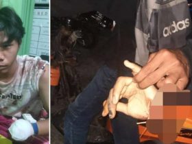 Remaja di Kendari Dikeroyok OTK, Tangan Kiri Putus Akibat Sabetan Sajam
