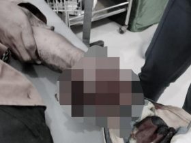 Tangan Sekuriti BMKG Kendari Hancur Akibat Petasan Rakitannya Meledak