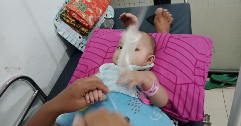 18 Orang Balita dan Dewasa Ikut Operasi Bibir Sumbing Gratis di BLUD RS Konawe