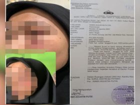 Mahasiswi UHO Jadi Korban Penganiayaan Dua Senior