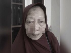 Seorang Lansia di Wakatobi Dianiaya Hingga Alami Luka-Luka Diwajah