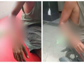 Pria di Kendari Terkena Busur Dilengan Hingga Tertancap