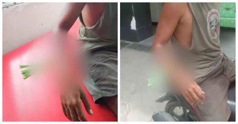 Pria di Kendari Terkena Busur Dilengan Hingga Tertancap