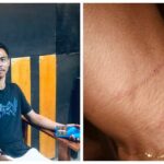 Diduga Dikeroyok Polisi, Warga Lakarinta Alami Kekerasan di Pantai Meleura