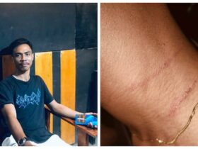 Diduga Dikeroyok Polisi, Warga Lakarinta Alami Kekerasan di Pantai Meleura