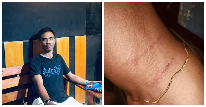 Diduga Dikeroyok Polisi, Warga Lakarinta Alami Kekerasan di Pantai Meleura